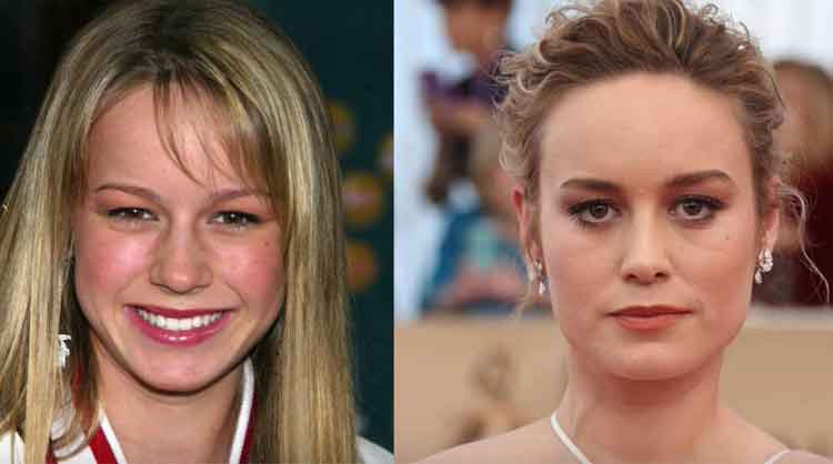 Brie Larson Plastic Surgery