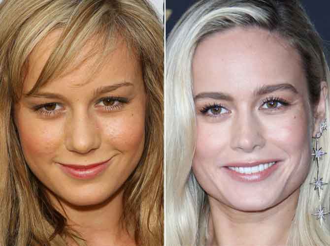 Brie Larson Plastic Surgery