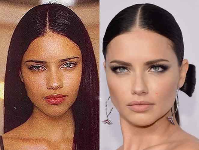 Adriana Lima Plastic Surgery 