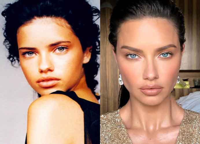 Adriana Lima Plastic Surgery