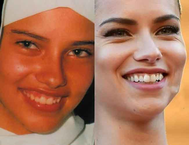 Adriana Lima Plastic Surgery: Boob job (boobs), Botox, Nose Job