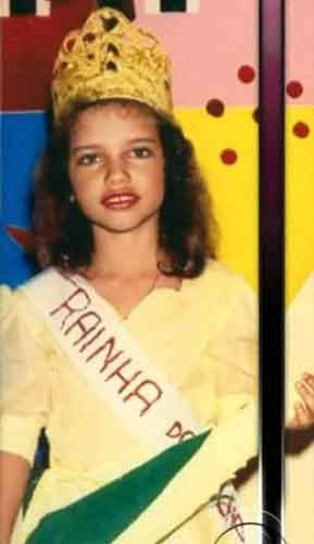 Adriana Lima Plastic Surgery