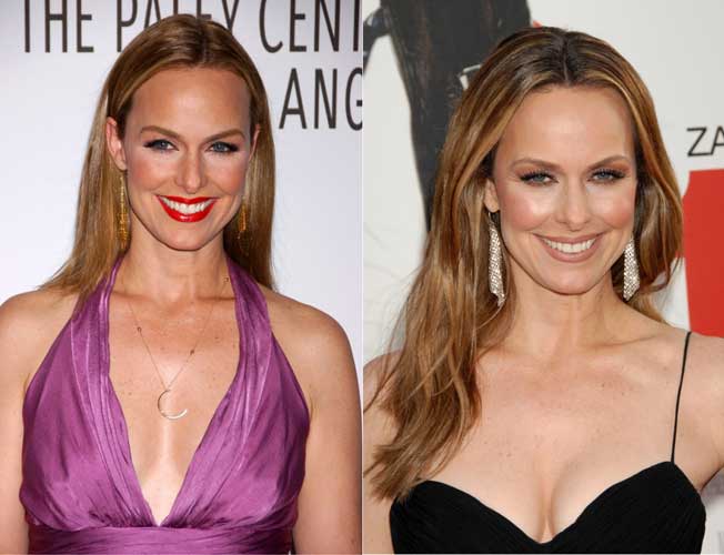 Melora Hardin Plastic Surgery