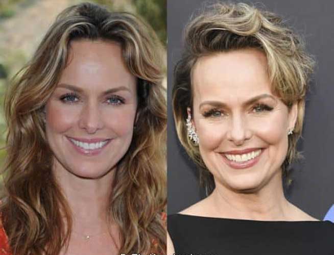 Melora Hardin Plastic Surgery