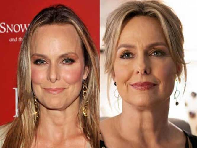 Melora Hardin Plastic Surgery