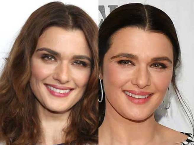 Rachel Weisz Plastic Surgery 