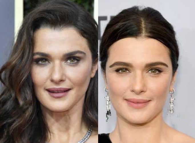 Rachel Weisz Plastic Surgery 