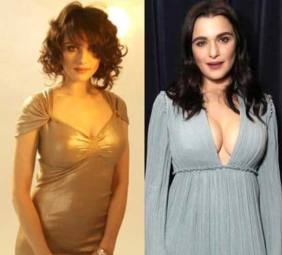 Rachel Weisz Plastic Surgery 