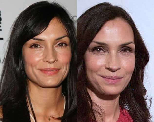 Famke Janssen Plastic Surgery