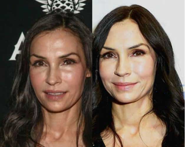 Famke Janssen Plastic Surgery Botox, Facelift, Nose Job