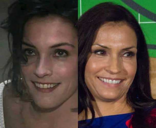 Famke Janssen Plastic Surgery