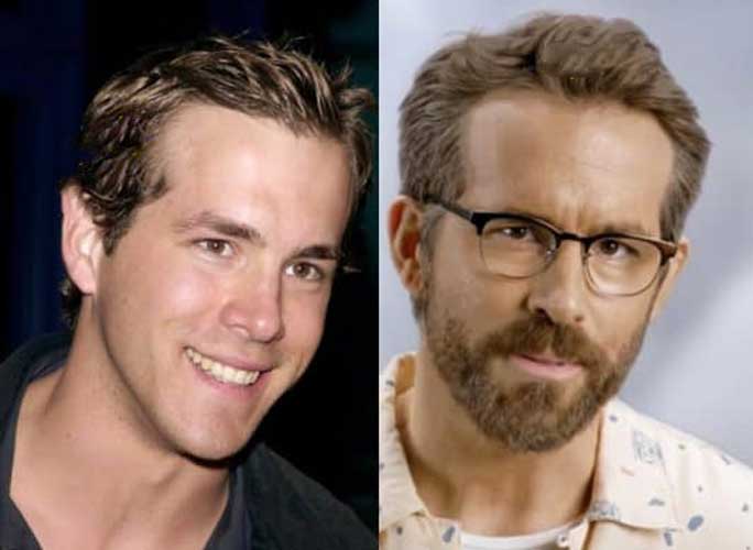 Ryan Reynolds Plastic Surgery Before and After: Did He Fix Teeth ...