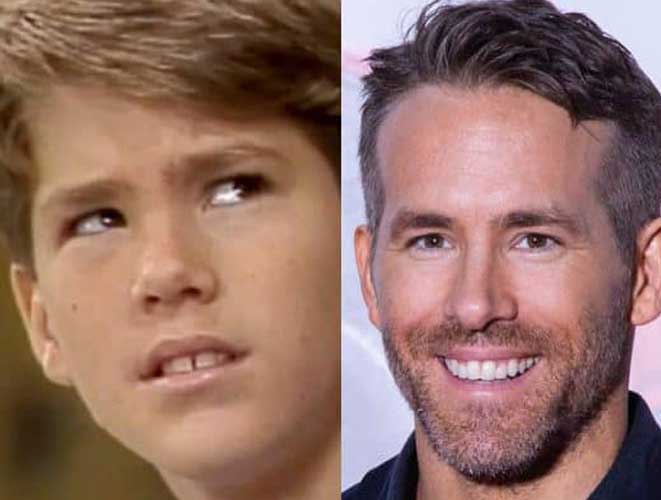 Ryan Reynolds Plastic Surgery