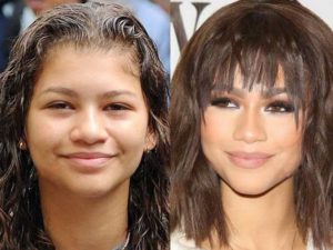 Zendaya Plastic Surgery: Boob Job, Nose Job and Lip Injections