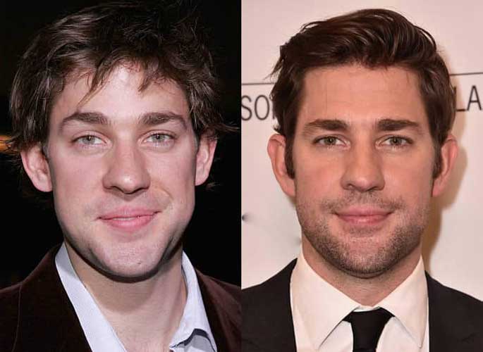 John Krasinski Plastic Surgery