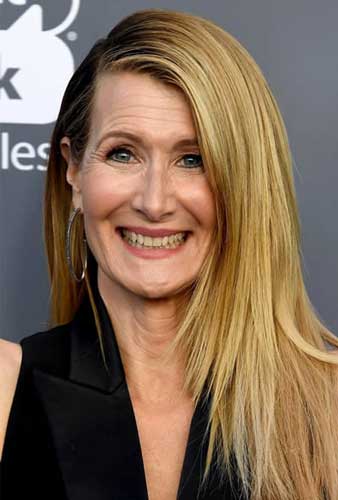 Laura Dern Plastic Surgery Botox Facelift Nose Job 