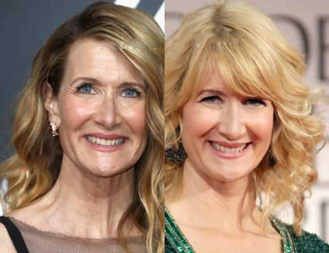 Laura Dern Plastic Surgery Botox Facelift Nose Job