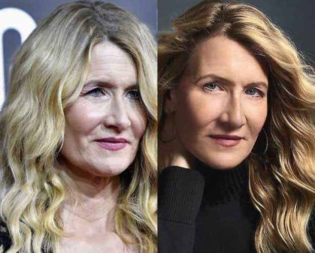 Laura Dern Plastic Surgery Botox Facelift Nose Job 