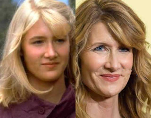 Laura Dern Plastic Surgery