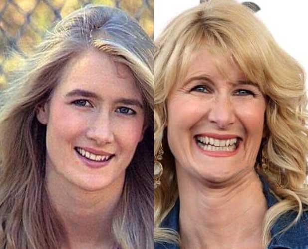 Laura Dern Plastic Surgery Botox Facelift Nose Job 