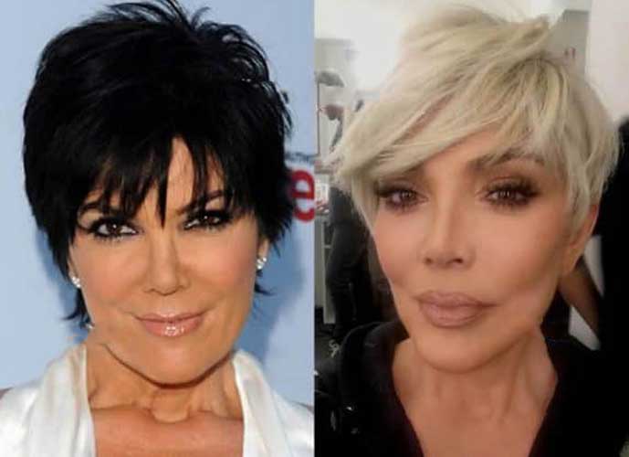 Kris Jenner Plastic Surgery