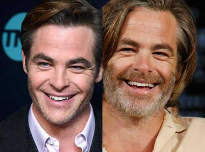 Chris Pine Plastic Surgery 