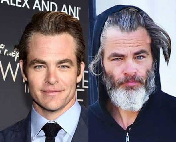 Chris Pine Plastic Surgery 