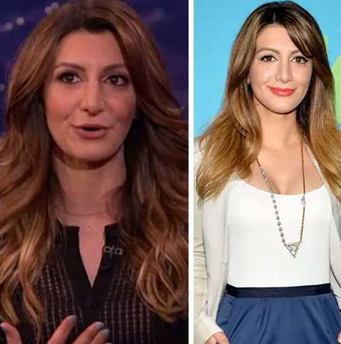 Nasim Pedrad Plastic Surgery