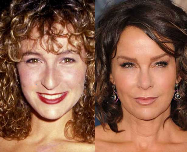 Jennifer Grey Plastic Surgery