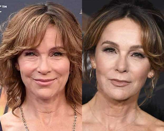 Jennifer Grey Plastic Surgery