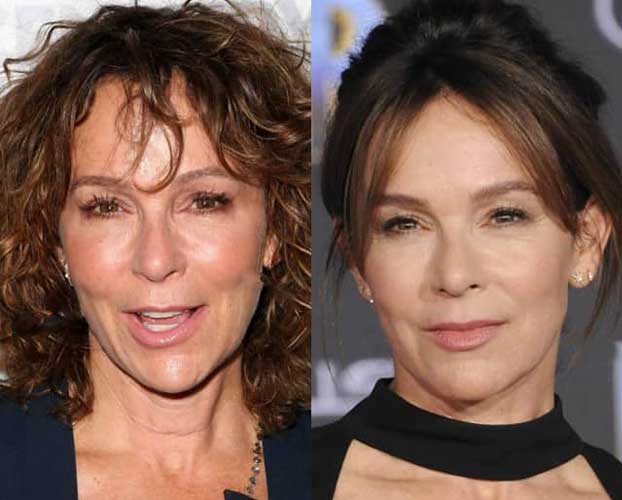 Jennifer Grey Plastic Surgery