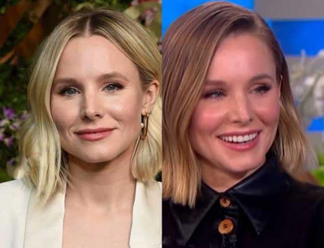 Kristen Bell Plastic Surgery Botox and Nose Job