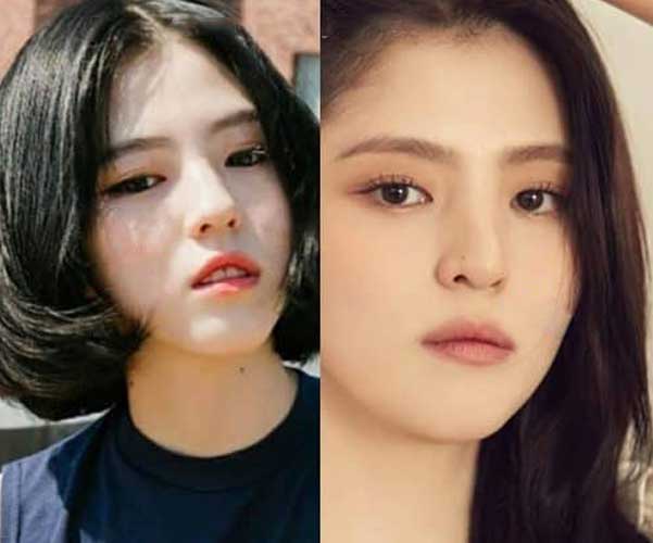 Han So Hee Plastic Surgery