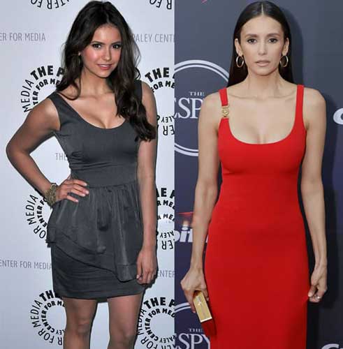 Nina Dobrev Plastic Surgery